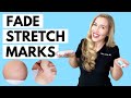 Fade Stretch Marks! | Ingredients that WORK and the Science to Back it up