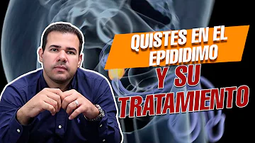 ¿Duele un quiste epididimario?