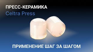 Пресс-керамика Celtra Press | Применение шаг за шагом