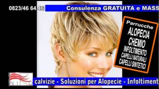 parrucche alopecia effetto naturale Caserta, Napoli, Campania,