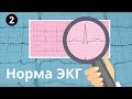 Норма ЭКГ. Все интервалы и зубцы: p, QRS, T, PR, ST