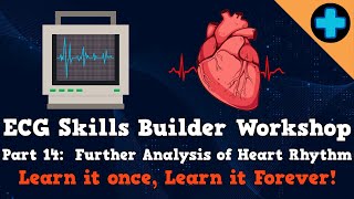 Electrocardiogram (ECG) Skills Builder Workshop Part 14: Further Analysis of Heart Rhythm