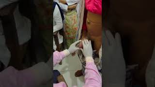 Examination Of Scrotal Swelling(Part-2) || Scrotal Swelling Short Case for Final Prof Examination