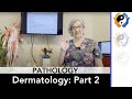 Dermatologic Pathologies: Part 2
