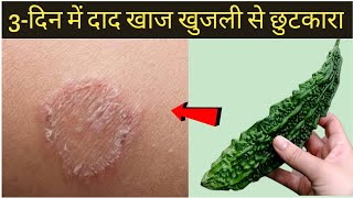 3-दन म दद खज खजल क 100% दस इलजDad Khaj Khujli Ka Ilaj