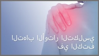 التهاب الأوتار التكلسي في الكتف