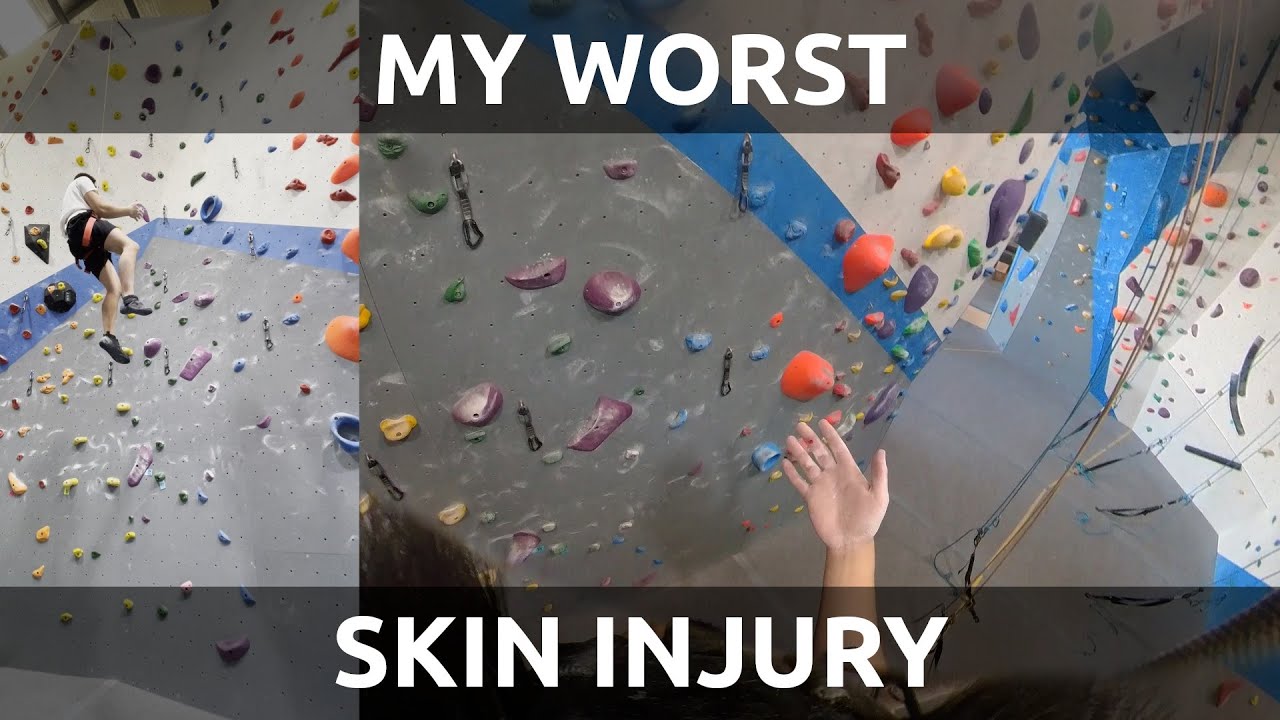 Ripping skin on 5.10d/6b+ top rope | POV Climbing Session