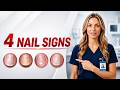 Your Nails Are Sending You Signals — Here's What They Mean After 60 | Dr Stella
