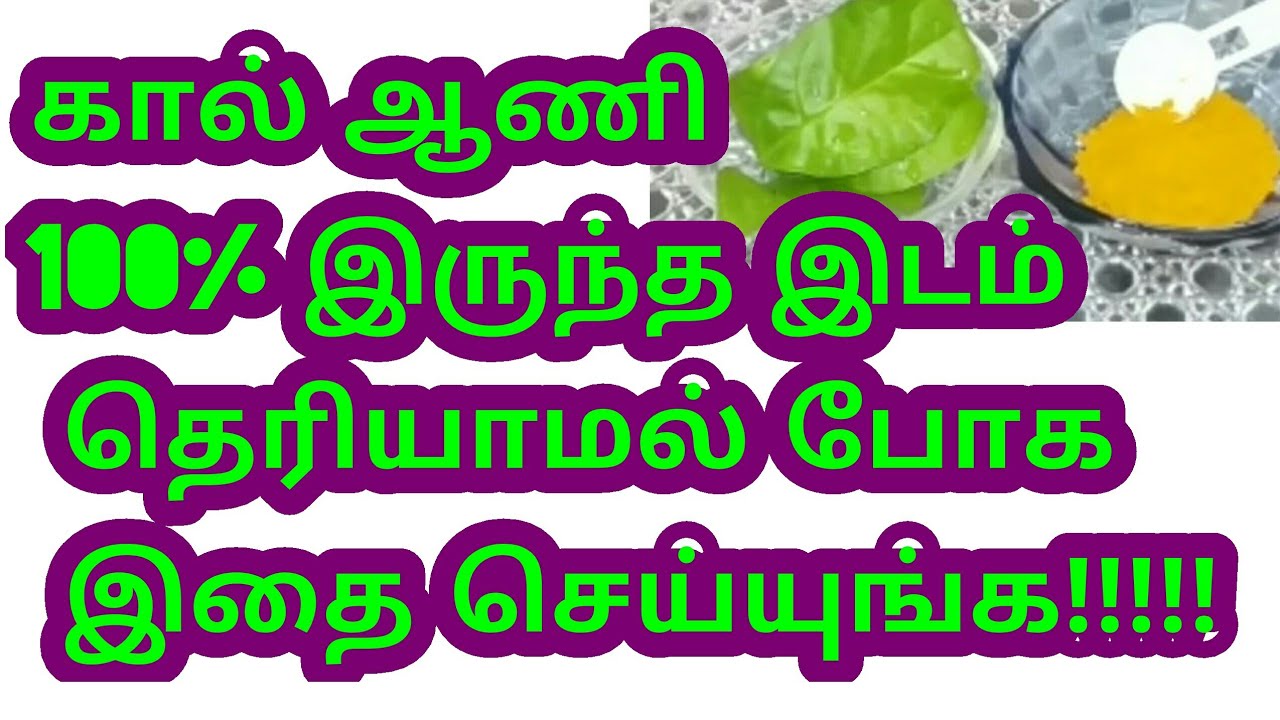 கால் ஆணி இருந்த இடம் தெரியாமல் போக இதை செய்யுங்க!!!!! Foot corn home remedy in Tamil YouTube