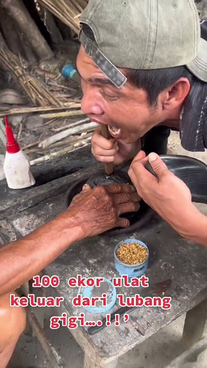 cara mengeluarkan ulat di gigi 😱