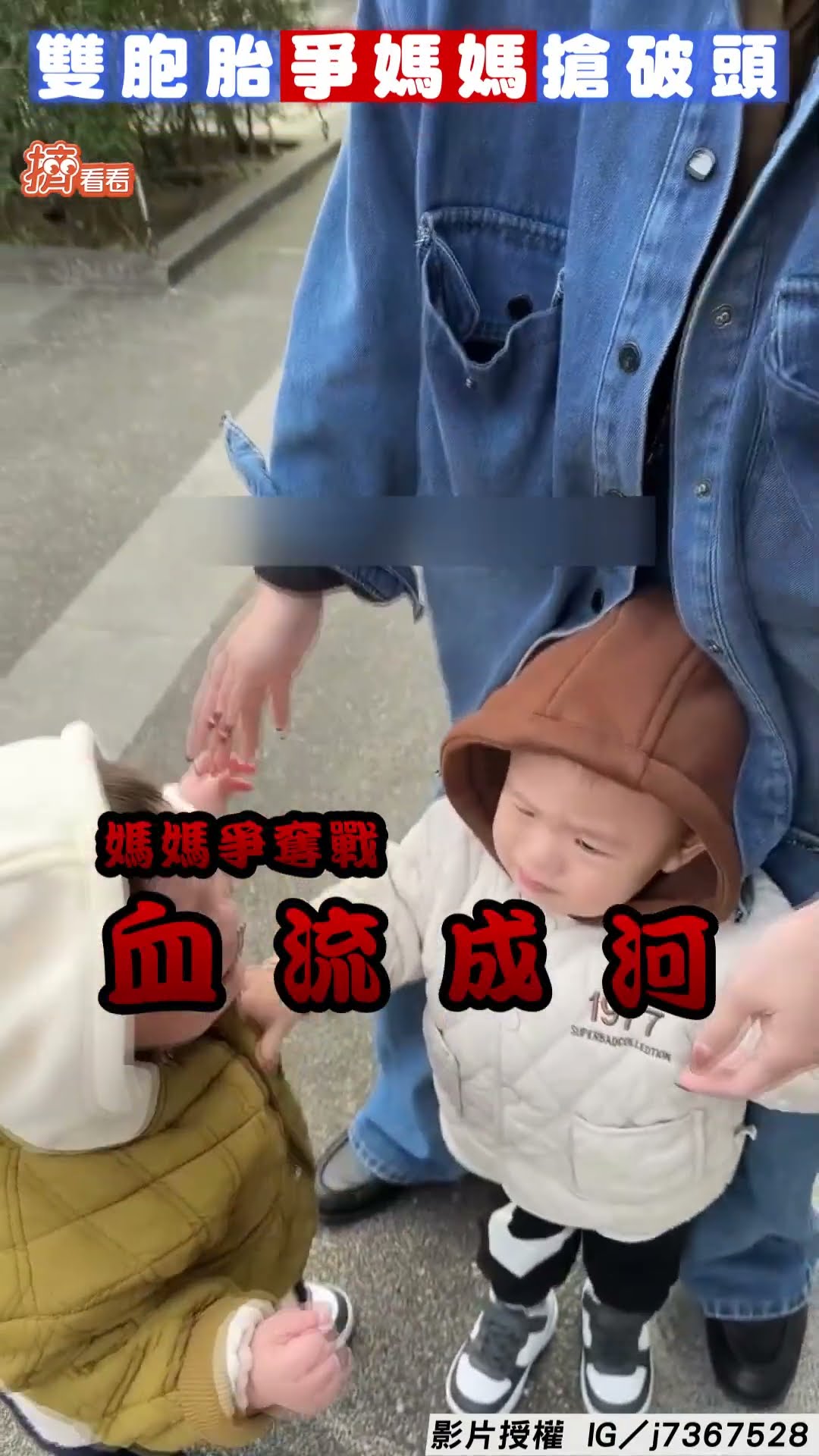 雙胞胎為向媽爭寵搶到血流成河! 爸笑喊:你們老婆自己找好嗎?｜TVBS新聞@TVBSNEWS01