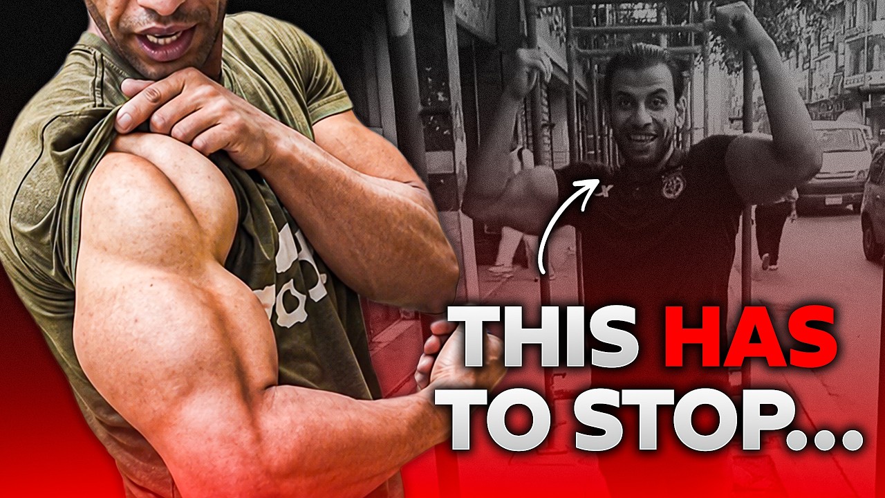 This Guy's Arms Are Horrifying...