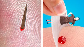 IF A SPLINTER WAS A PERSON! DIY Life Hacks & More By Hungry Panda