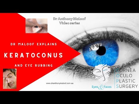 Keratoconus and rubbing your eyes. Is eye rubbing good or bad? Dr Anthony Maloof - Sydney, Australia