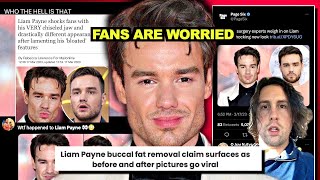 Liam Payne SHOCKS with NEW LOOK..