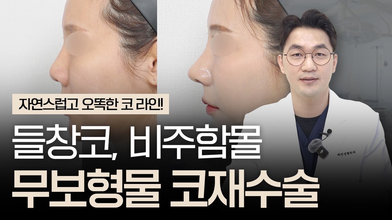 자가늑연골 코재수술｜무보형물, 비주함몰, 짧은코수술 후기 사례｜민성기 원장