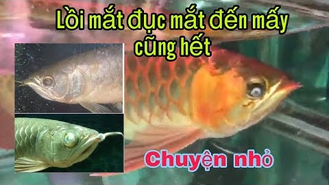 Xử lý đục mắt lồi mắt đơn giản ! Hiệu quả . Ko có gì phải ngại😘