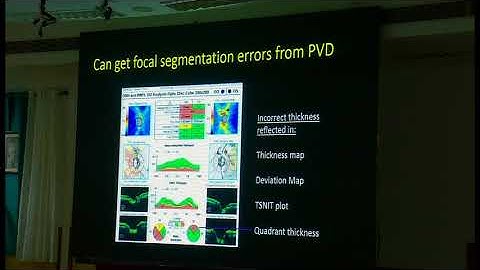 OCT for structure and progression analysis