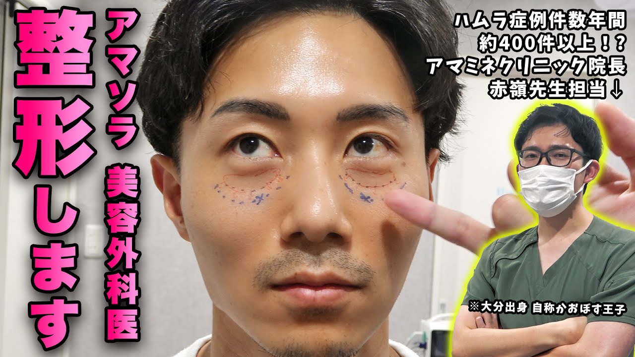 アマソラドクターが美容整形を受ける!!ハムラは100%再発で話題の赤嶺先生が施術を担当!