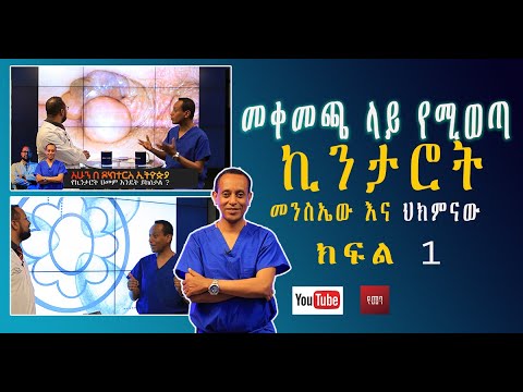 ቪዲዮ: ወደ ላይ የሚወጣ ዘንግ ምንድን ነው?