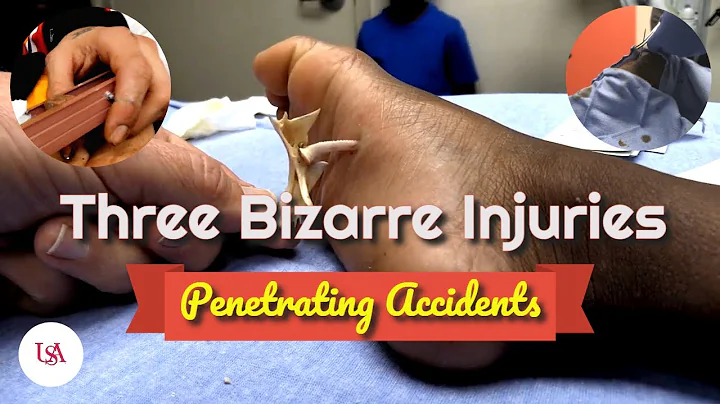 Three Bizarre Accidental Injuries