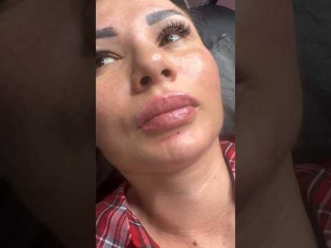 Самые кайфовые губы -можно сделать у меня в кабинете #косметологростов #увеличениегубростов