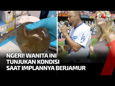 Implan Payudaranya Berjamur, Wajah Wanita Ini Bikin Ngeri | tvOne Minute