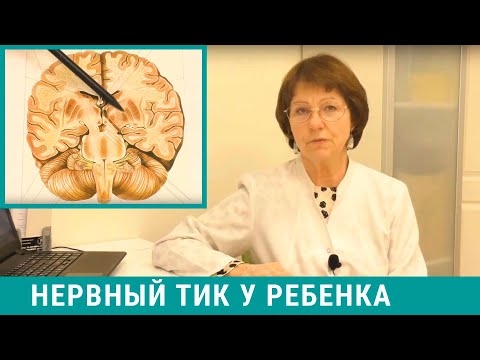 Нервный тик у ребенка - как мы лечим