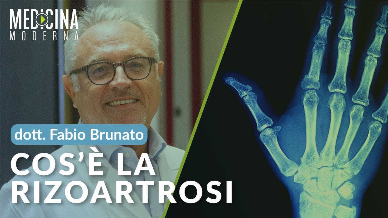 Rizoartrosi: cos'è e come può essere trattata - Dott. Fabio Brunato