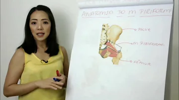 Como diagnosticar a síndrome do piriforme?