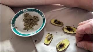 Download lagu Live - acu-moxa cancer protocol nausea WBC count neuropathy stress