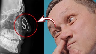 Shocking Truth: Picking Your Nose Could Kill You!