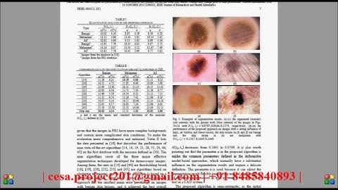 A Novel Approach to Segment Skin Lesions in Dermoscopic Images Based on a Deformable Model
