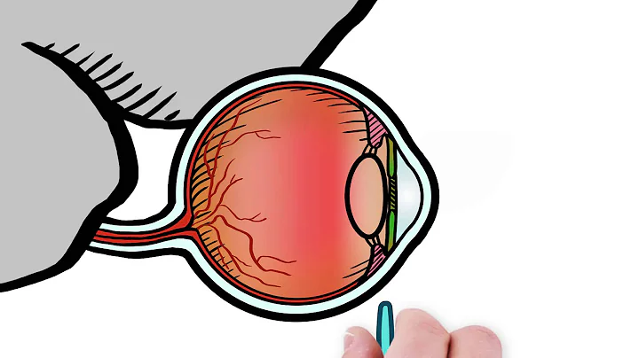 Laser Cataract Surgery with Dr. Colby Stewart