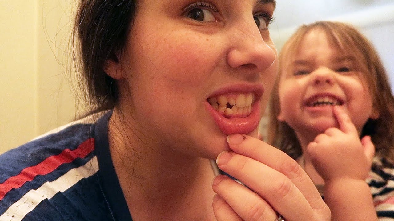 Finally Losing My Last Baby Tooth! ***EeeeK AlerT!! YouTube