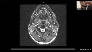Make Discussions About MRI's Come to Life by Stoy Law Group, PLLC 255 views 3 years ago 15 minutes