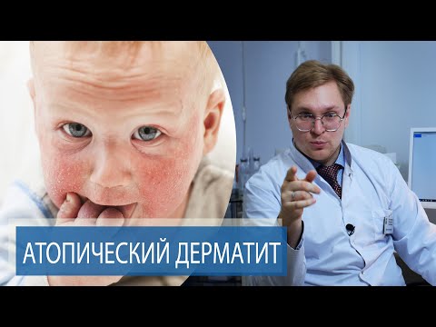 Диатез чем лечить в домашних условиях