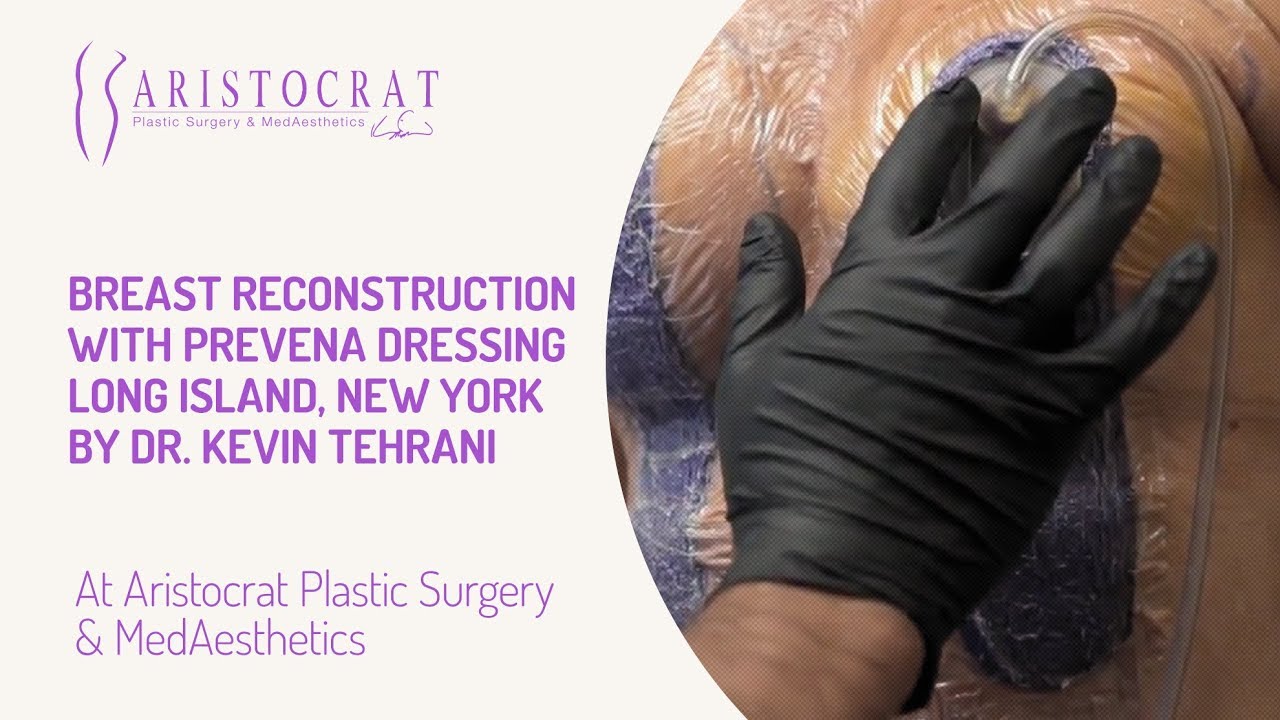 Breast Reconstruction with Prevena Dressing Long Island, New York by Dr. Kevin Tehrani
