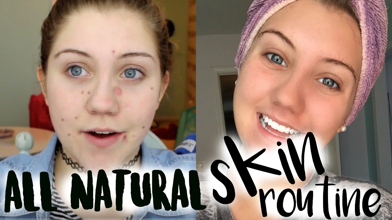 HOW TO CLEAR YOUR SKIN NATURALLY - YouTube
