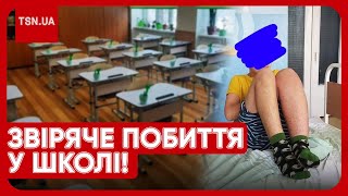 🤯⚡️ У Києві 13-річного хлопчика жорстоко побили у школі: нога збільшилась у півтора раза!