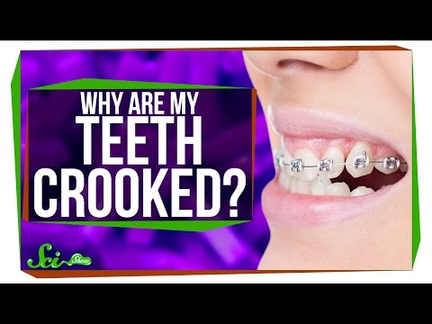 Video: Kas sukelia kreivius dantis?