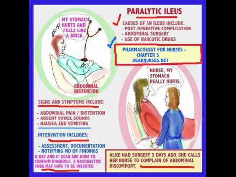 What is basic pharmacology for nurses?