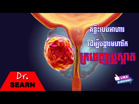 Protective foods for prostate cancer គន្លឹះរបបអាហារ ដើម្បីបង្ការមហារីកក្រពេញប្រូស្តាត