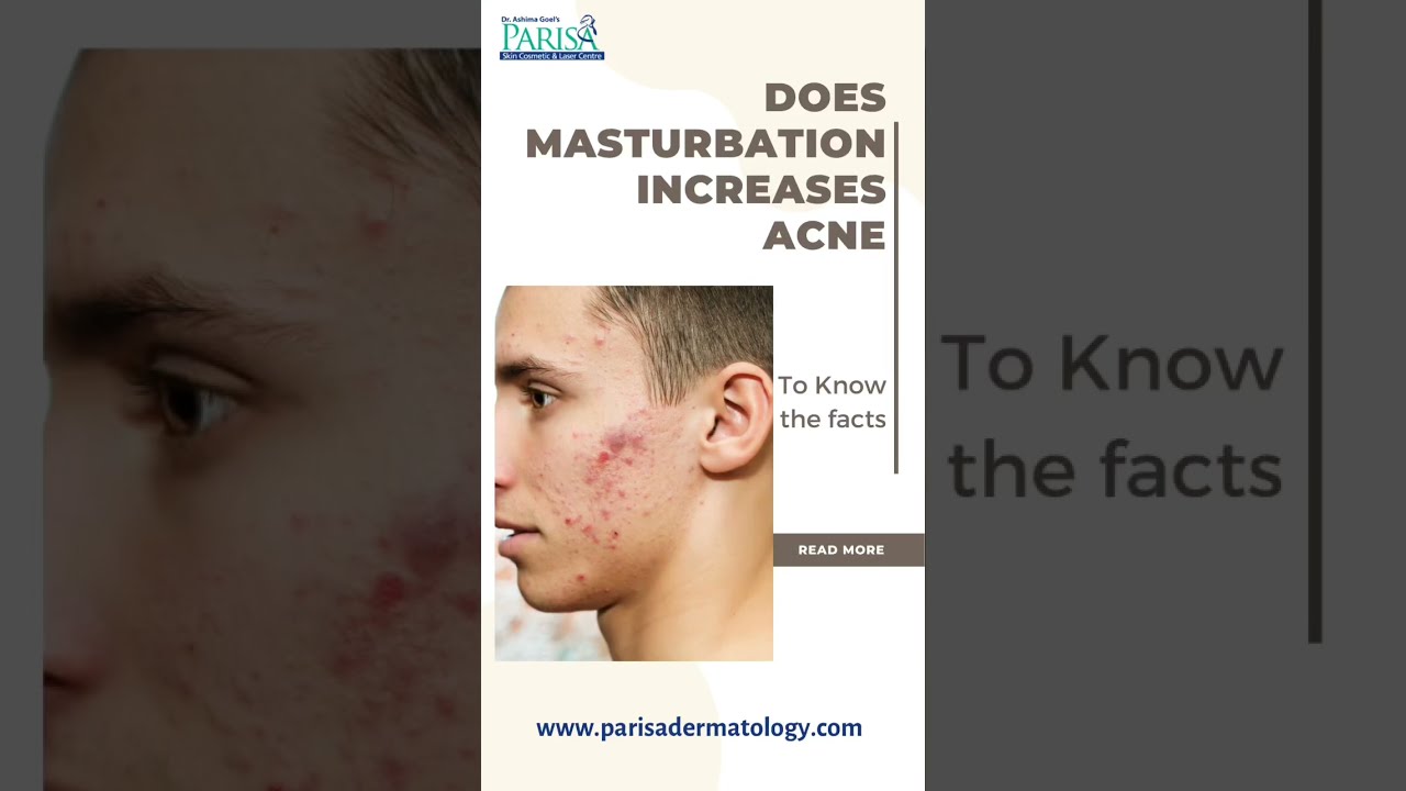 Facts You Should Know About Masturbation And Acne Drashimagoel Parisaskinclinic Youtubeshorts