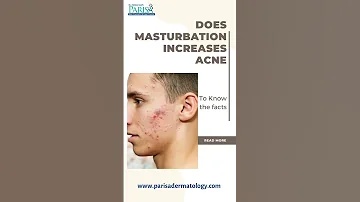 Facts You Should Know About Masturbation And Acne Drashimagoel Parisaskinclinic Youtubeshorts 