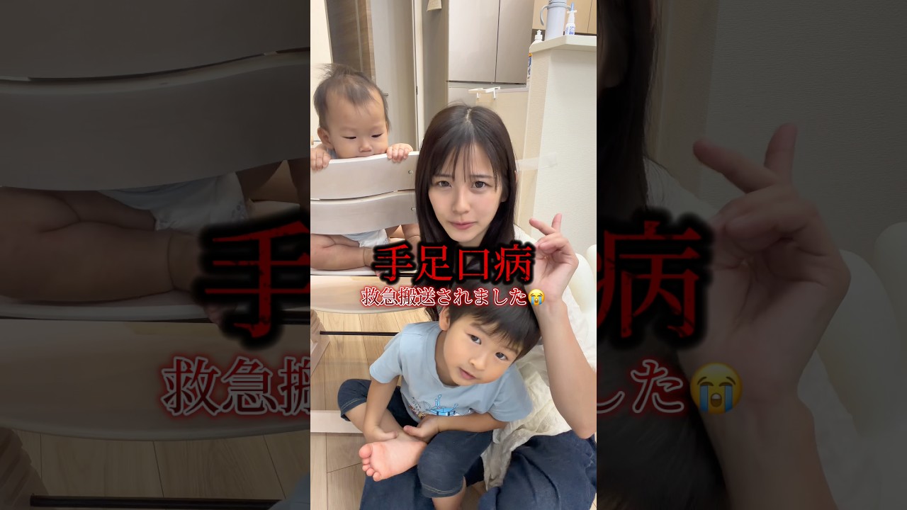 手足口病、インフルエンザよりしんどかったです😭 #ママ #赤ちゃん #2歳 #手足口病