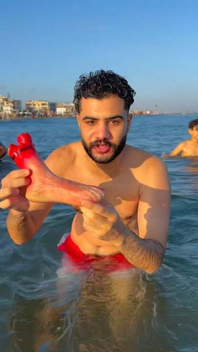 سمكه قرش عضتني من رجلي اتقطعت😰