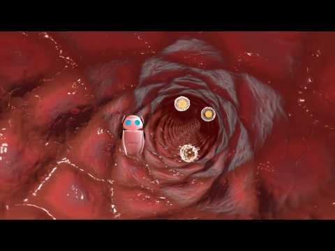 Click to Play Video