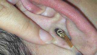 耳かきくらぶ【その37 】- Ear cleaning,Ear wax removal How to clean ear wax Part37.  - 귀청소37 - 귀파기37  - 掏耳朵37