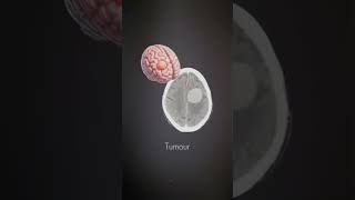 Show To CT Scan Report #hype #viral #reels #trending #video #doctor #akhil #hospital #medical #viral